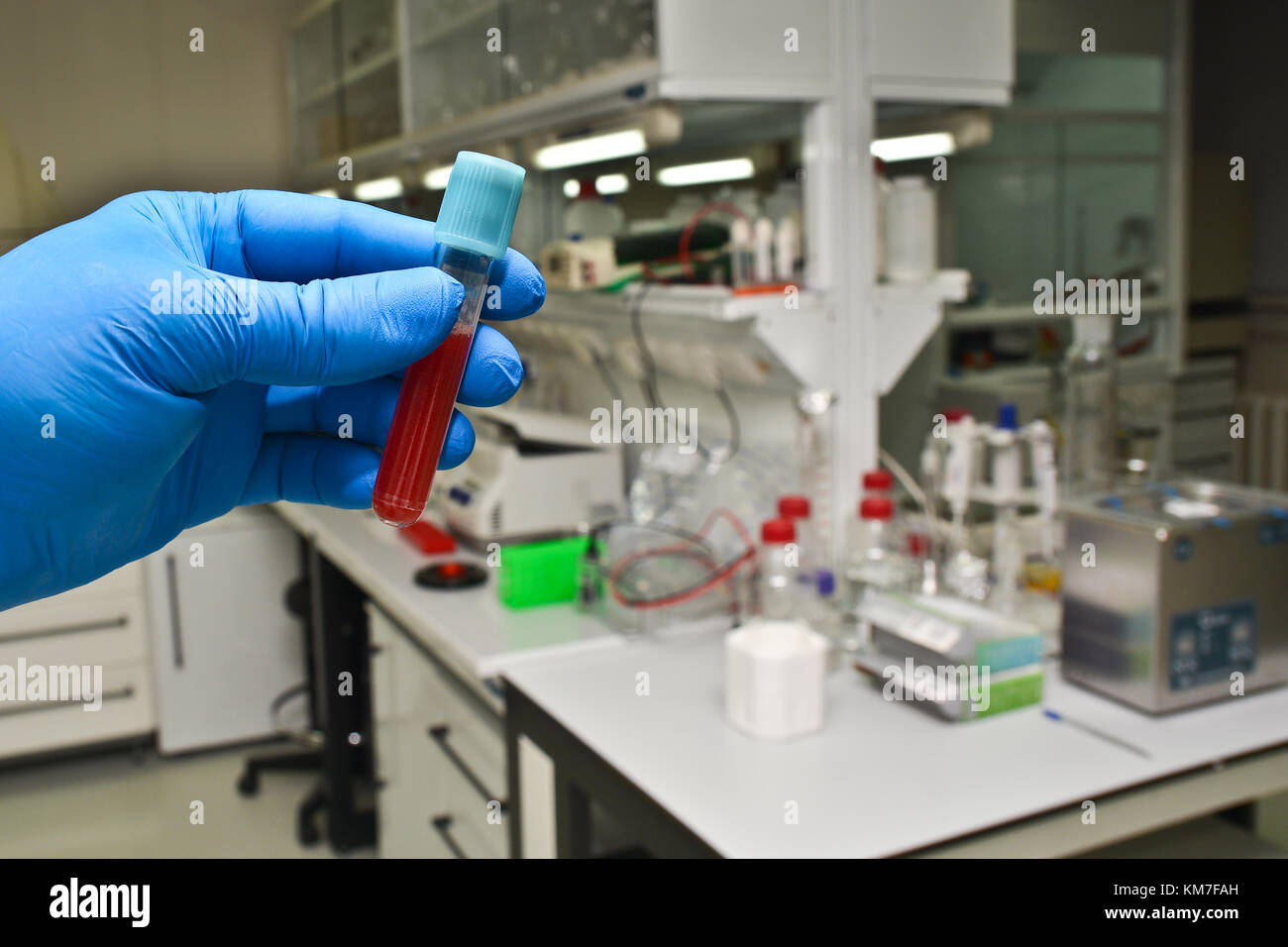 Blood test in the laboratory. The test tube with a biological sample