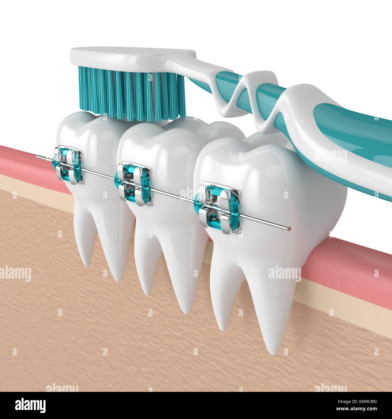 3d render of teeth with braces and toothbrush isolated over white ...