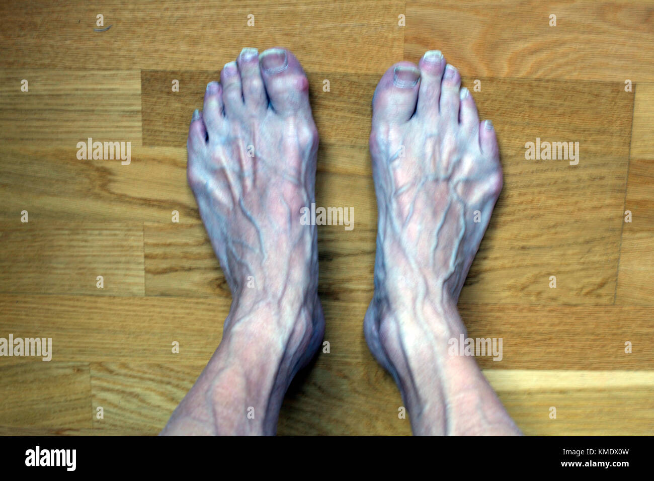 ugly Feet Stock Photo