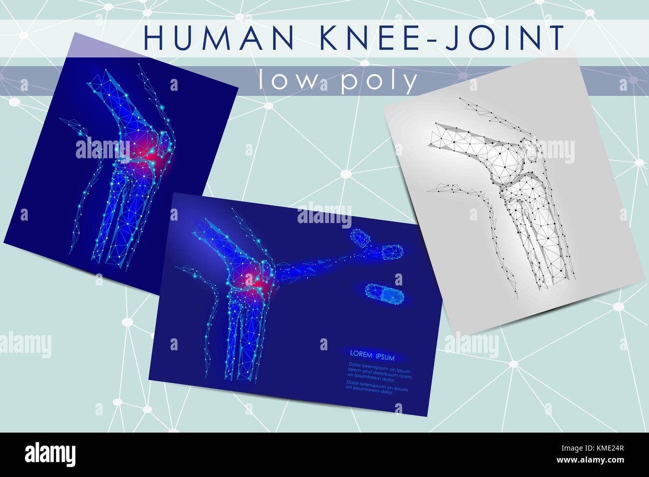 Human knee-joint low poly medicine science illustration set. Knee anatomical pain cure concept. Help keep health drug mechanism action on joint vector polygonal geometric point line Stock Vector