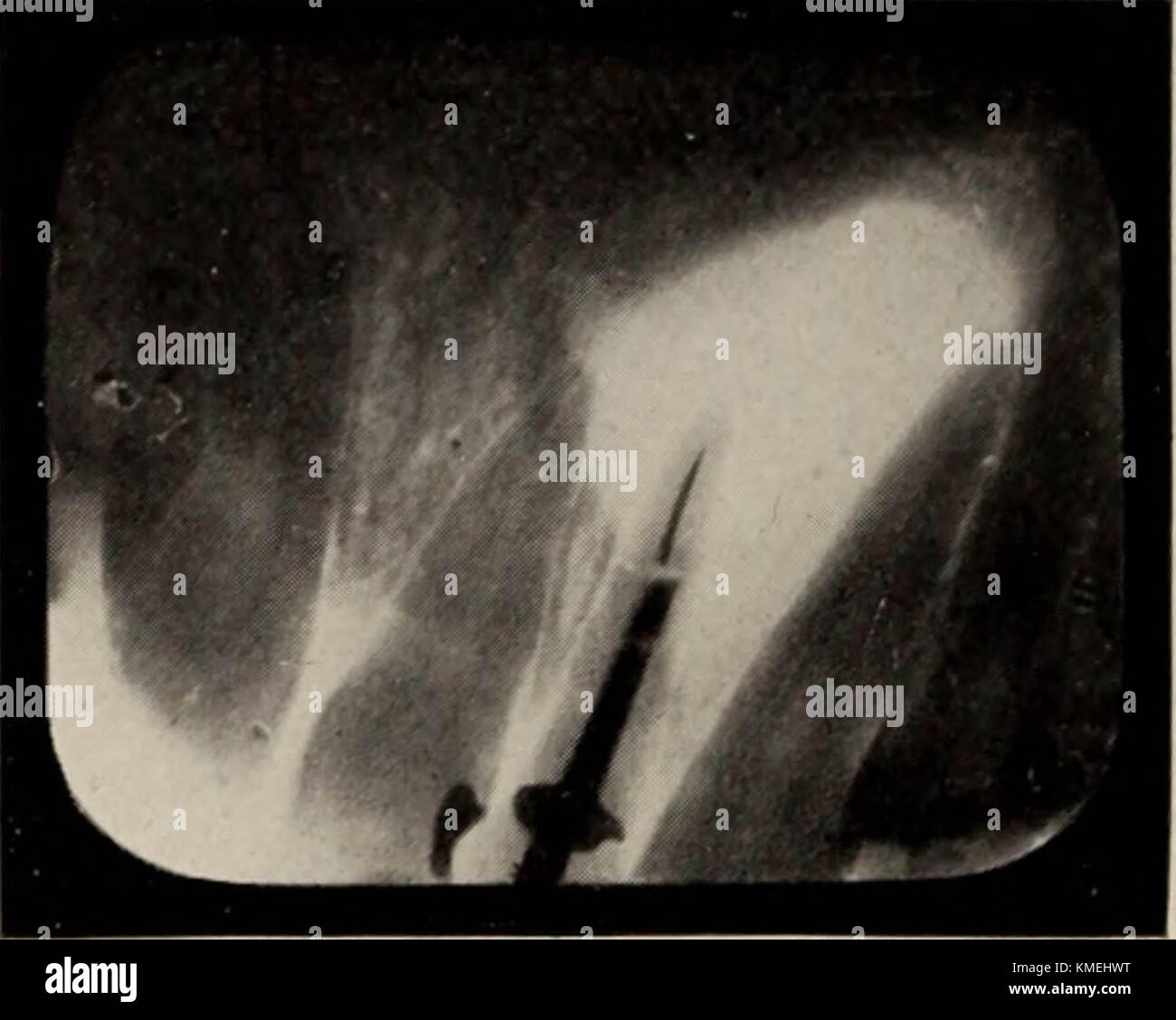 History of dentistry hires stock photography and images Alamy