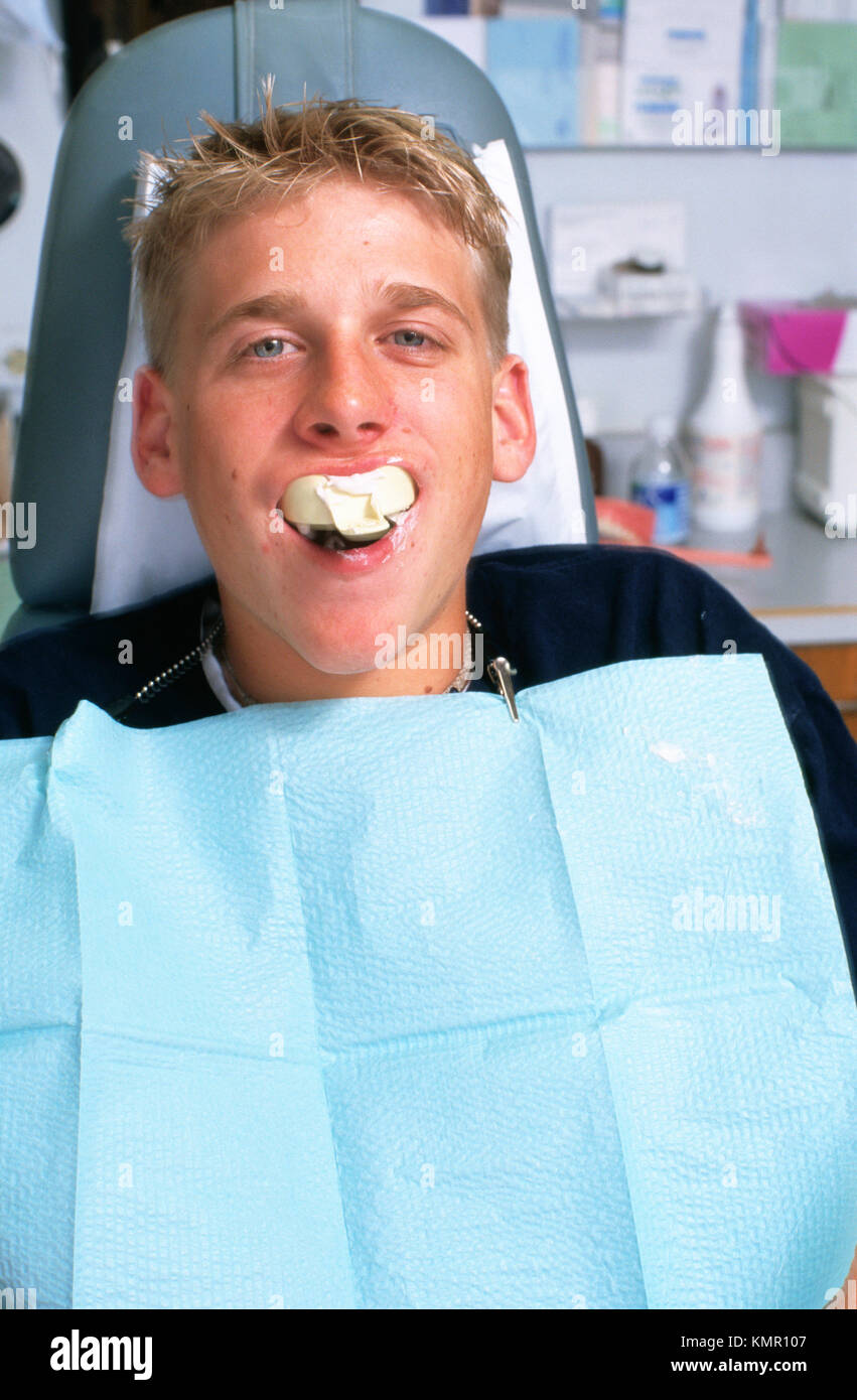 Teen boy at dentist, taking dental impressions Stock Photo Alamy