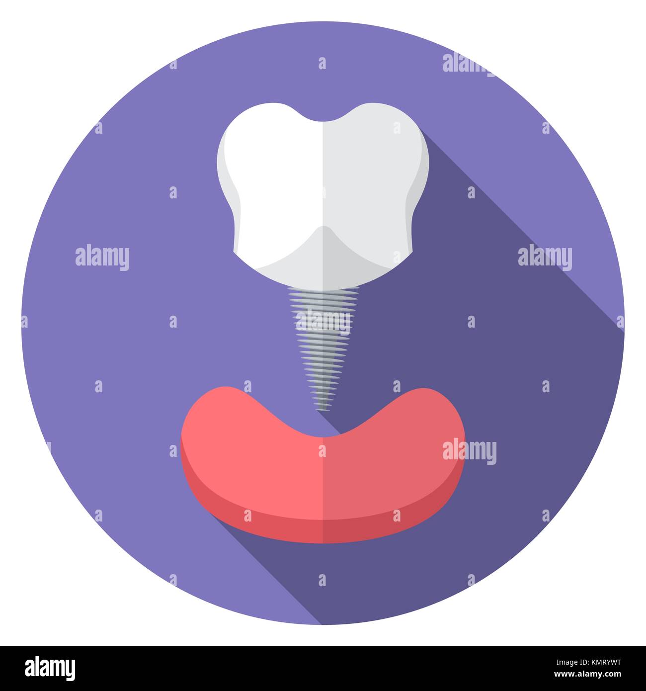 Flat design modern vector illustration of tooth implant icon with long ...