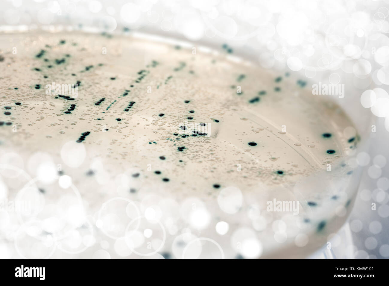 Agar plate with bacterial colonies transformed with plasmid DNA Stock Photo