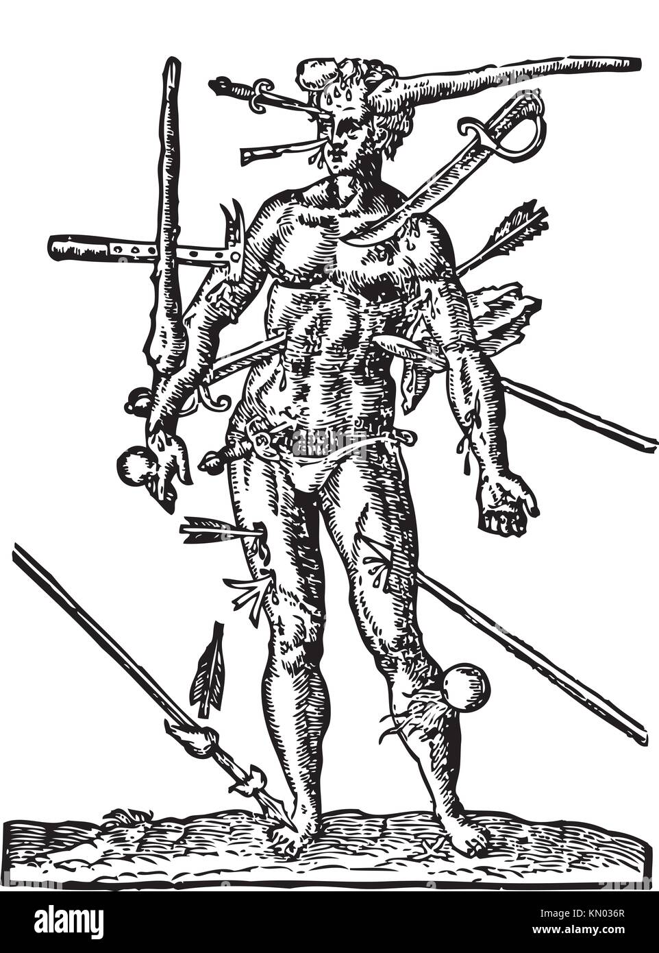 The Man of Wounds old engraving Illustration from the Opera Chirurgica, by Ambroise Paré 1594  Shows a man with multiple wounds made by weapons, such Stock Photo