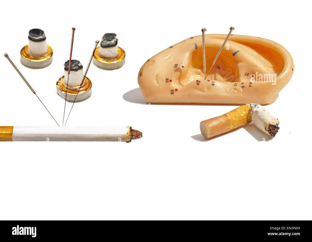 Acupuncture to stop smoking Stock Photo Alamy
