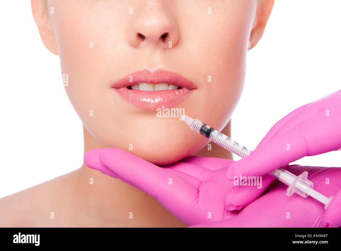 Beautiful plump lips injection with collagen filler Cosmetic spa beauty treatment with pink gloves, on white. Stock Photo