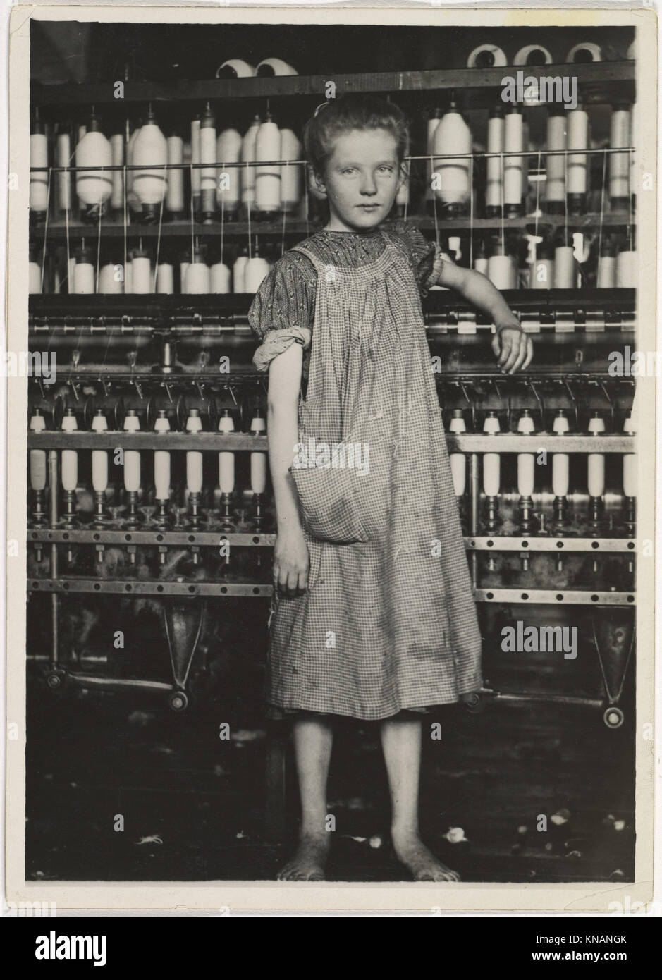 Addie Card, 12 years. Spinner in North Pownal Cotton Mill. Girls in mill say she is ten years. She admitted to me she was twelve; that she started during school vacation and now would  stay . Location- Vermont MET 0013 Addie Card, 12 years. Spinner in North Pownal Cotton Mill. Girls in mill say she is ten years. She admitted to me she was twelve; that she started during school vacation and now would  stay . Location- Vermont MET 0013 /301919 Stock Photo