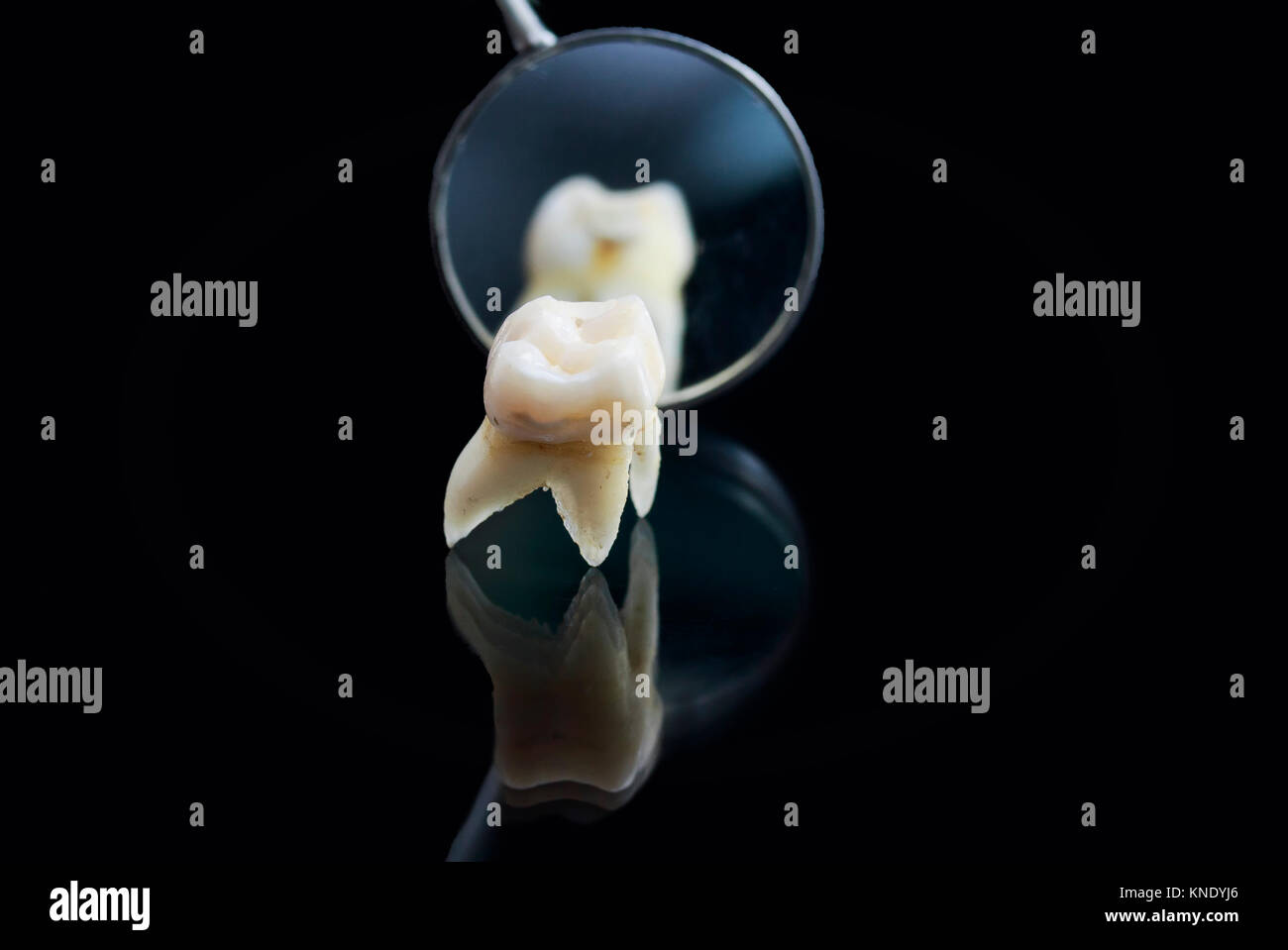 Pulled Rotten Tooth bad rotten tooth is pulled out and is located opposite the dental ...