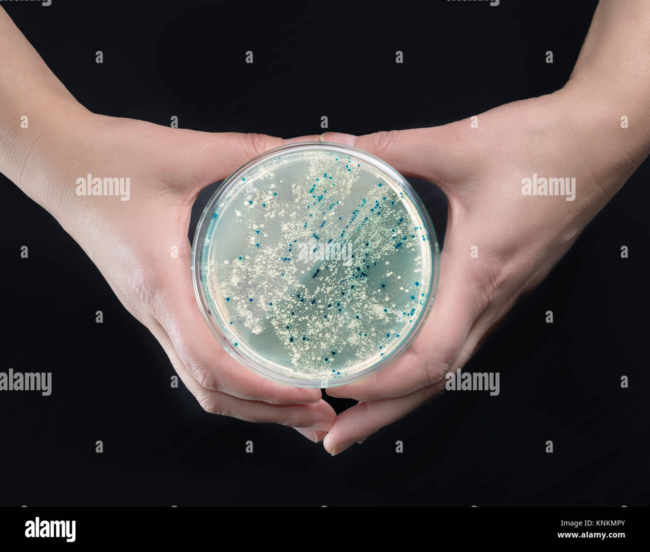 Hands holding agar plate with bacterial colonies for plasmid vector cloning Stock Photo