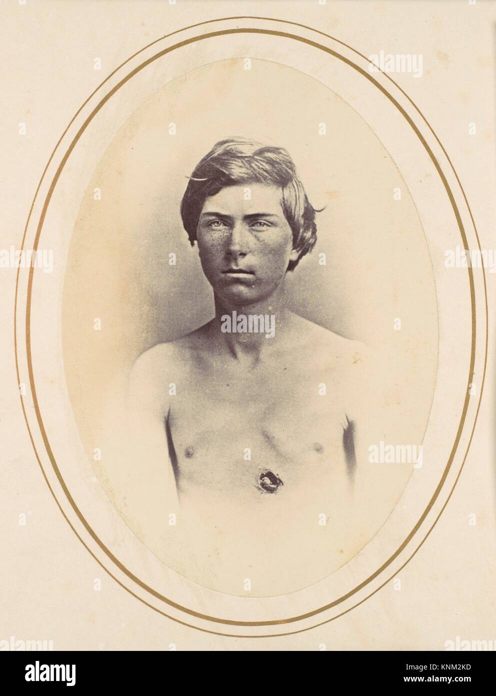 Frederick A. Bentley. Artist Reed Brockway Bontecou (American, 1824