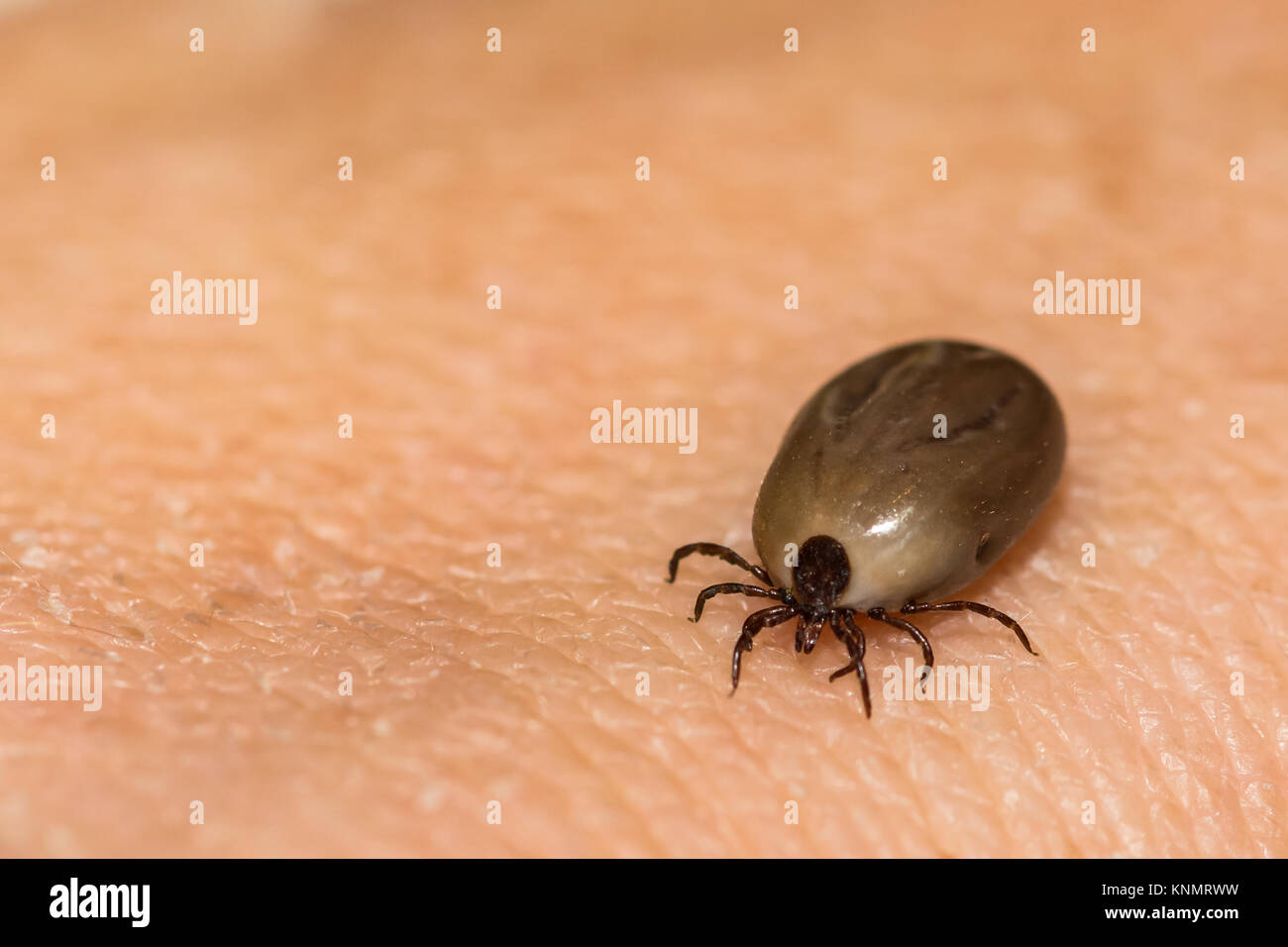 An engorged female Deer Tick removed from an accidental host. Stock Photo