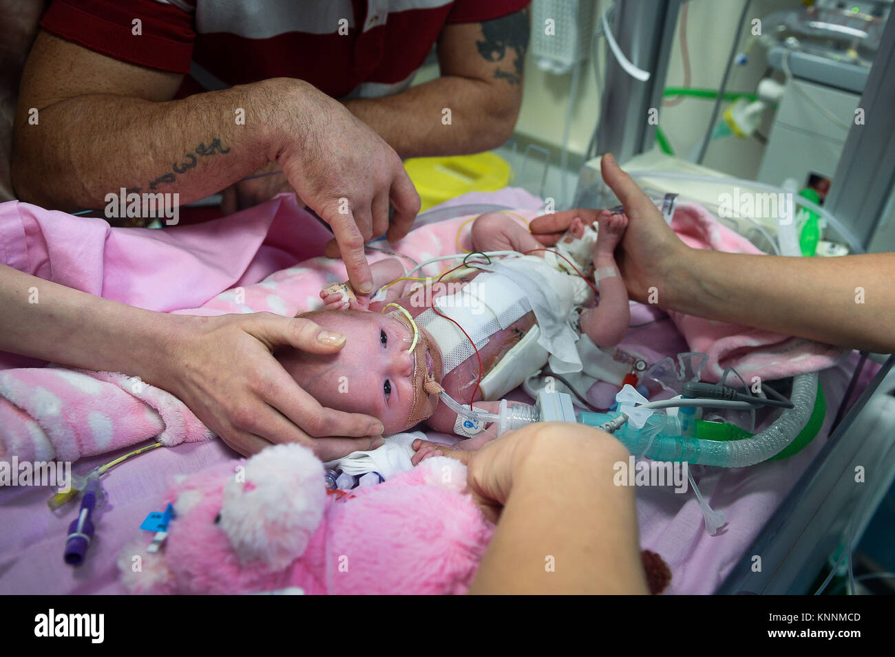 Three-week-old Vanellope Hope Wilkins, who was due to be delivered on Christmas Eve before an incredibly rare condition, in which the heart grows on the outside of the body, meant she had to be born prematurely by caesarean section on November 22, is caressed and touched by her parents Naomi Findlay and Dean Wilkins, at Glenfield Hospital in Leicester, after surviving, in what is believed to be a UK first. Stock Photo