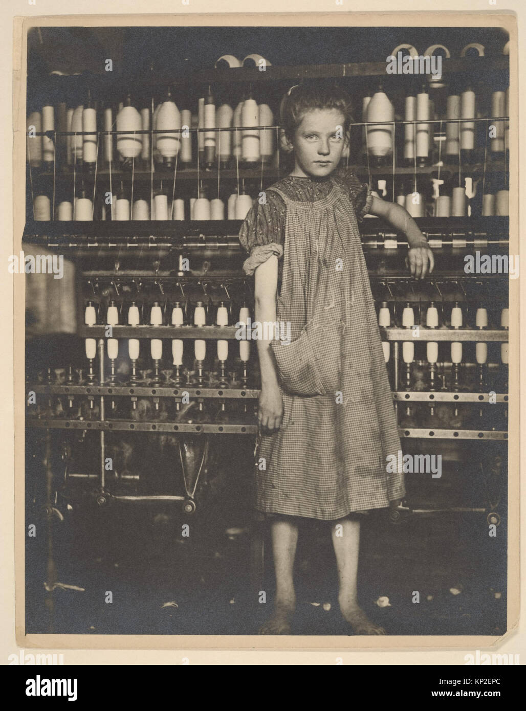 Addie Card, 12 years. Spinner in North Pownal Cotton Mill. Girls in mill say she is ten years. She admitted to me she was twelve; that she started during school vacation and now would  stay . Location- Vermont MET 0012 Addie Card, 12 years. Spinner in North Pownal Cotton Mill. Girls in mill say she is ten years. She admitted to me she was twelve; that she started during school vacation and now would  stay . Location- Vermont MET 0012 /285844 Stock Photo