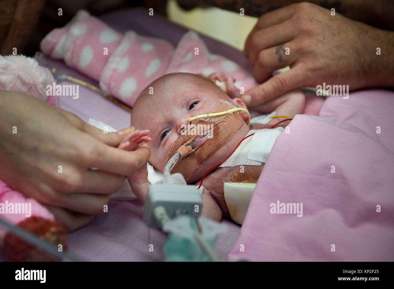 Three-week-old Vanellope Hope Wilkins, who was due to be delivered on Christmas Eve before an incredibly rare condition, in which the heart grows on the outside of the body, meant she had to be born prematurely by caesarean section on November 22, is caressed and touched by her parents Naomi Findlay and Dean Wilkins, at Glenfield Hospital in Leicester, after surviving, in what is believed to be a UK first. Stock Photo