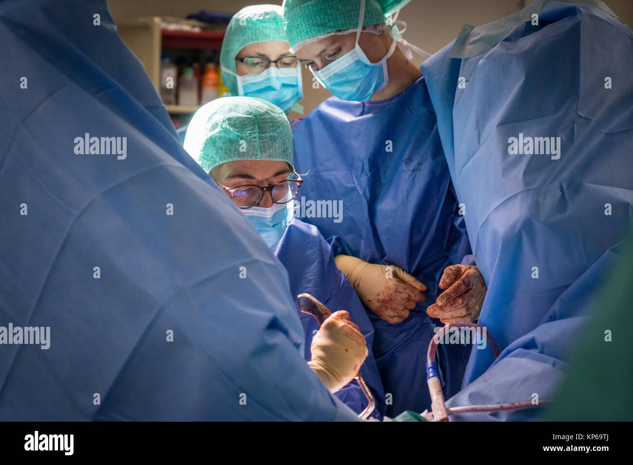 HYSTERECTOMY Stock Photo Alamy