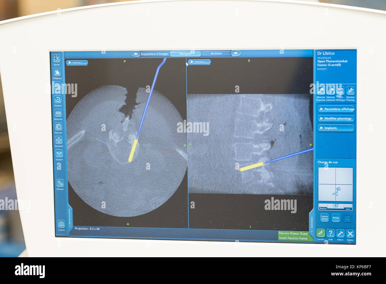 3d ct scan lumbar spine hi-res stock photography and images - Alamy