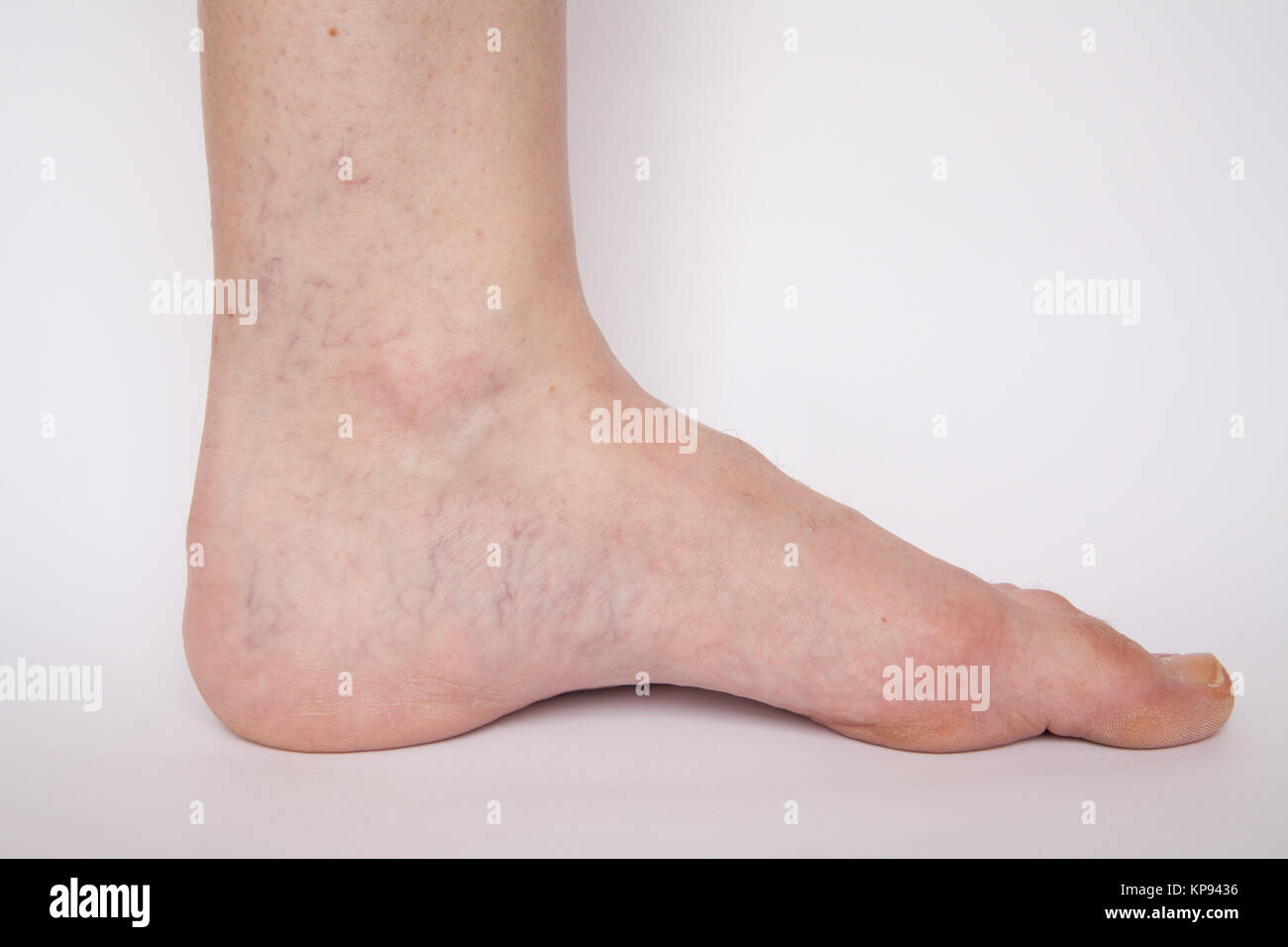 Veiny Feet Heels