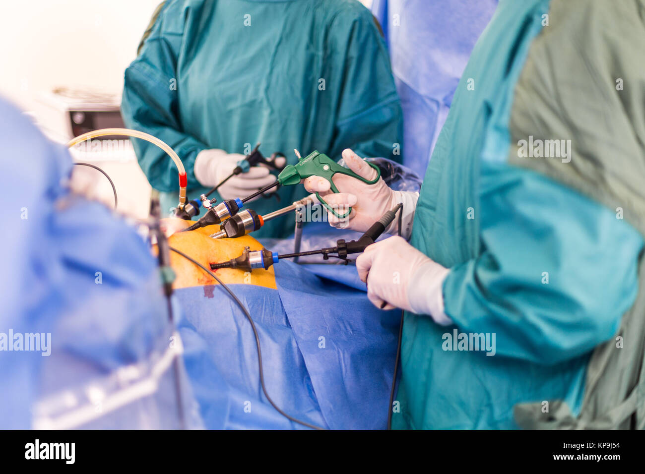 Hysterectomy performed by coelioscopy, Angouleme hospital, France. Stock Photo