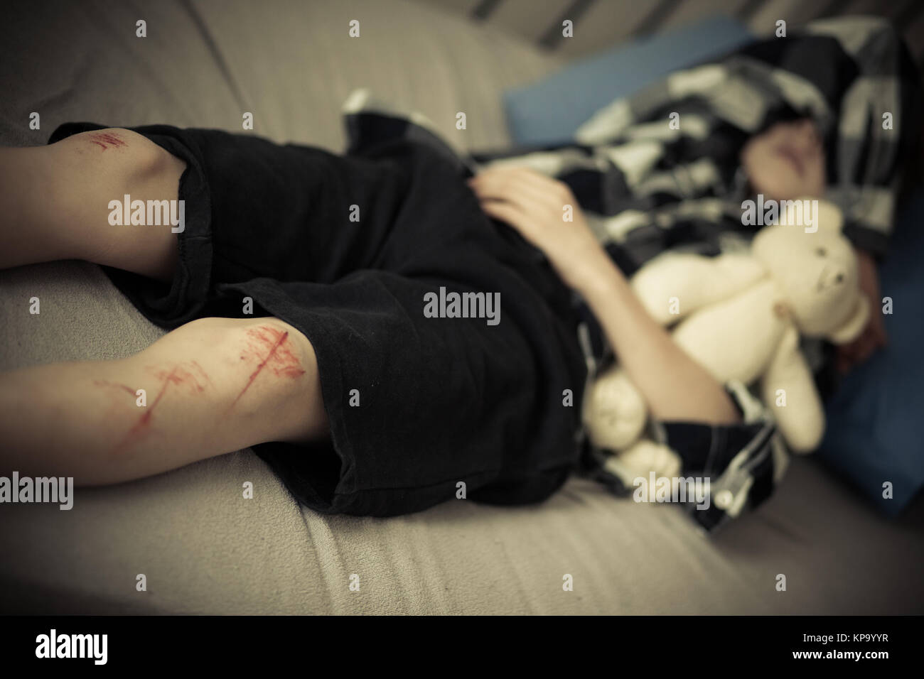 Boy With Injured Knee High Resolution Stock Photography and Images - Alamy
