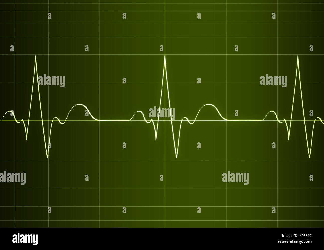 Cardiogramm on the screen. 2D Graphics. Computer Design Stock Photo - Alamy