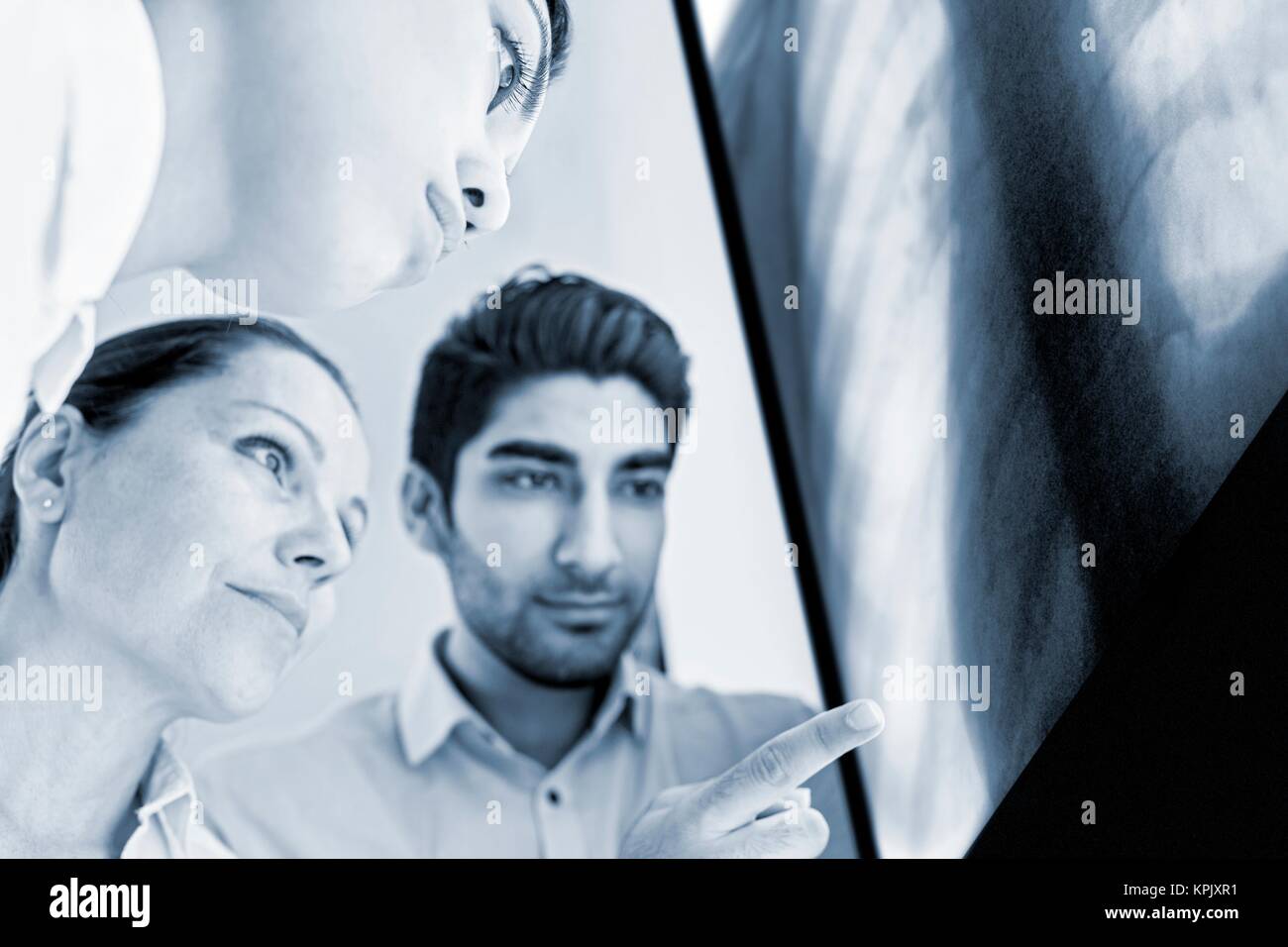Male and female doctors looking at x-ray of ribcage. Stock Photo
