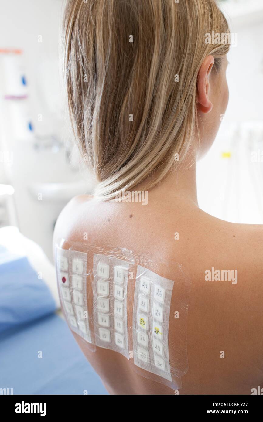 Patient undergoing a patch test in allergy clinic. Stock Photo