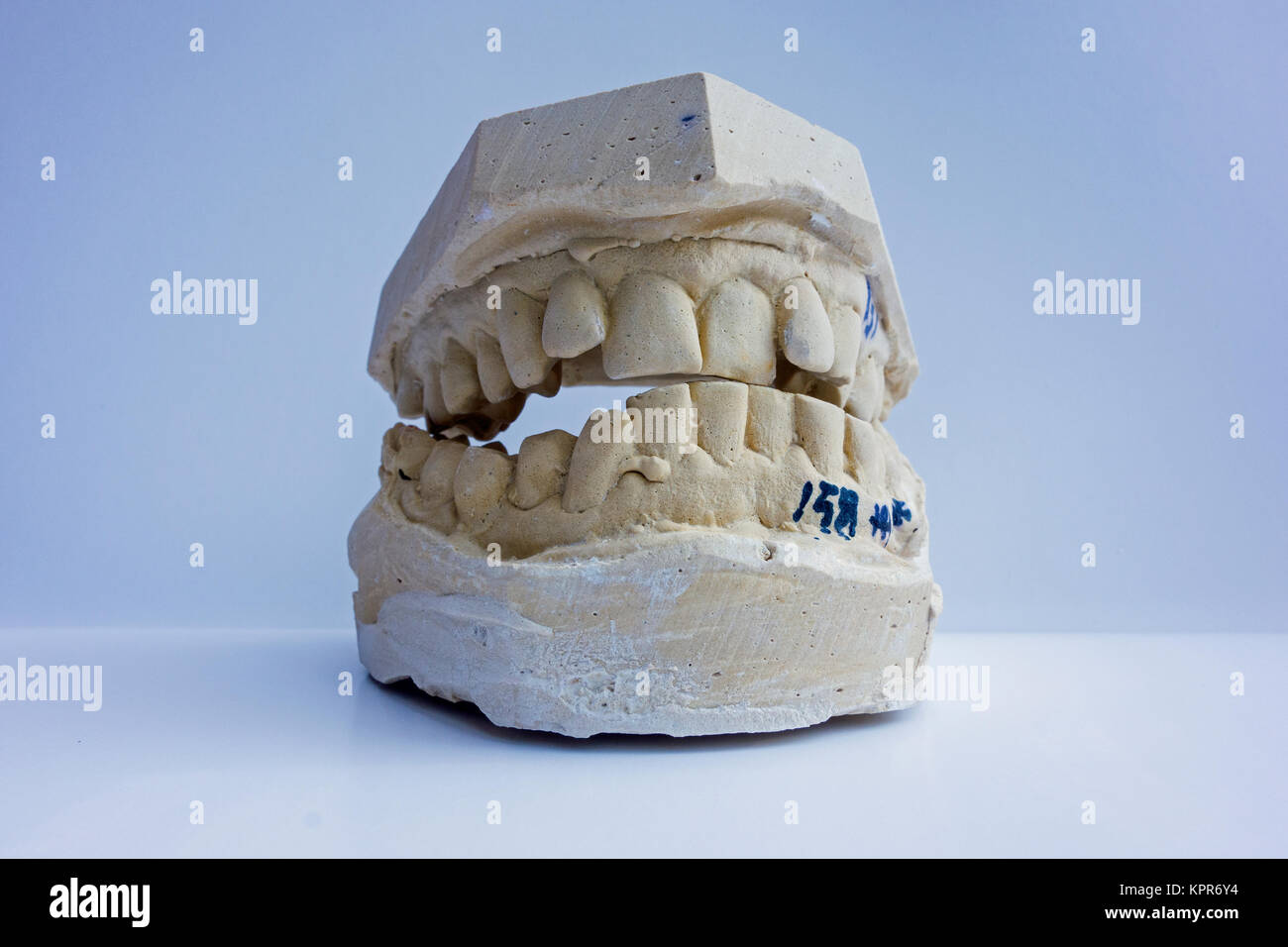 A mold , mould or impression of a man's teeth Stock Photo