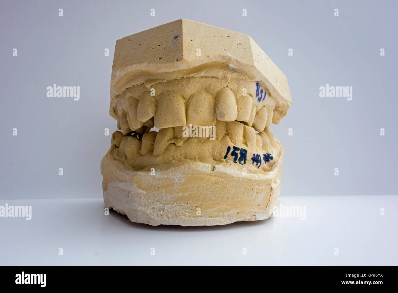 A mold , mould or impression of a man's teeth showing an overbite Stock Photo
