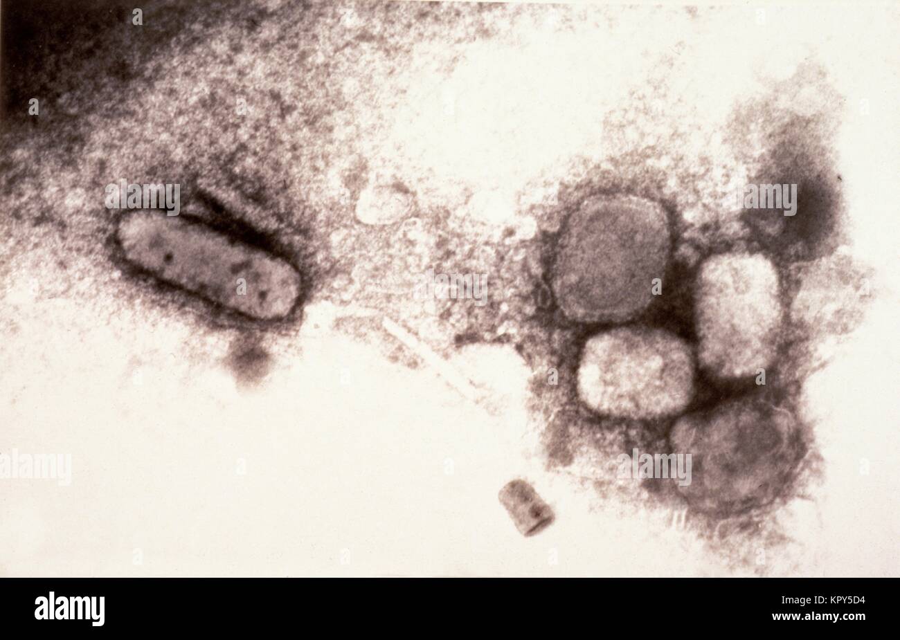 Electron micrograph of the smallpox virus (variola), 1970. Stock Photo