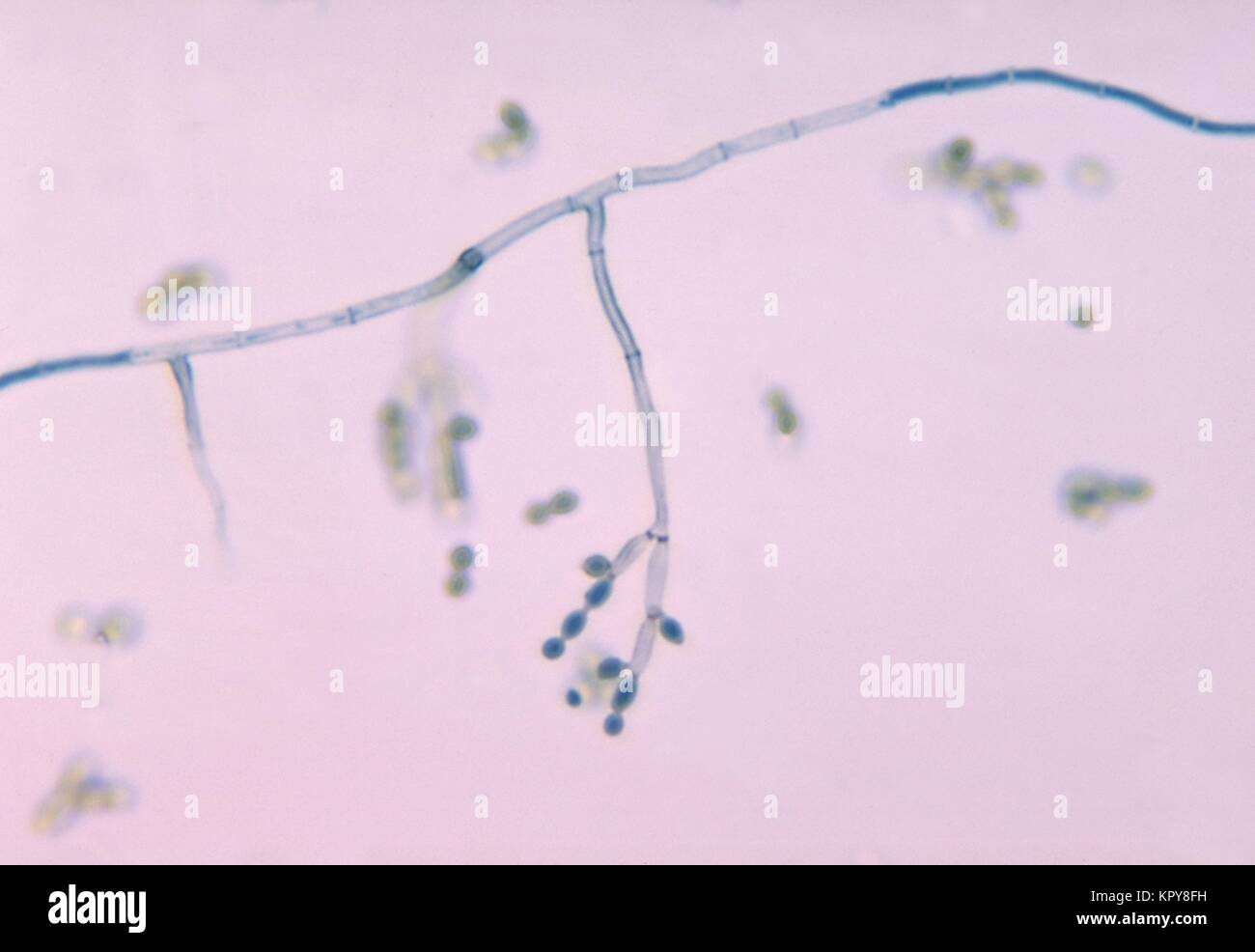 Photomicrograph of the fungus Cladosporium spp, 1969. prepared with the