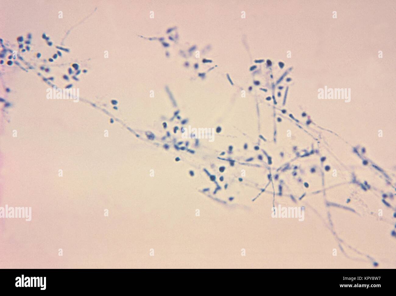 This is a photomicrograph of the fungus Microsporum gypseum using the lactophenol cotton blue staining technique. The dermatophyte M. gypseum, a natural soil habitant, can cause tinea corporis and tinea capitis in humans and animals, 1969. Other dermatophytes are included in the genera Epidermophyton and Trichophyton . Image courtesy CDC/Dr. Leanor Haley. Stock Photo