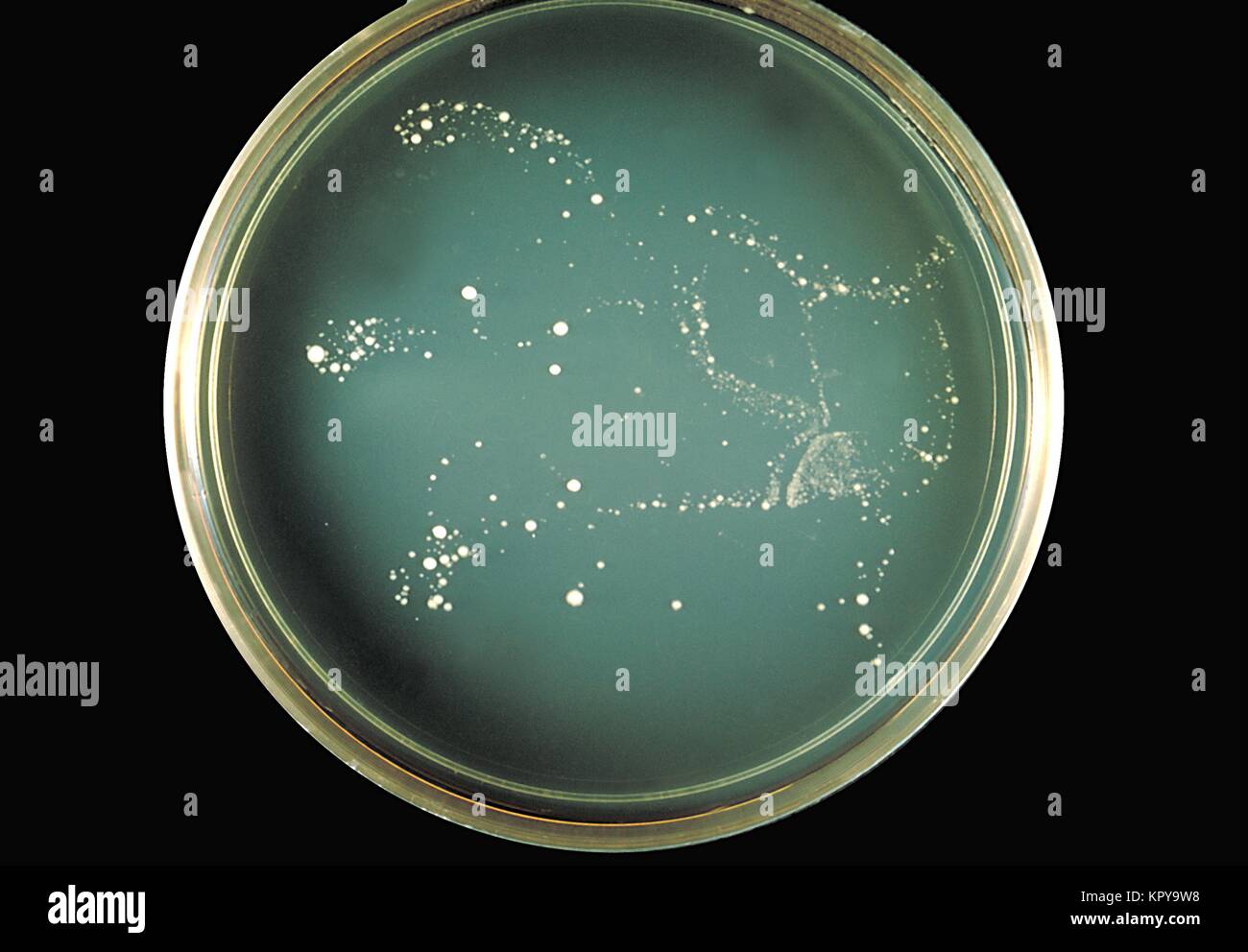 Cryptococcus neoformans fungus hires stock photography and images Alamy