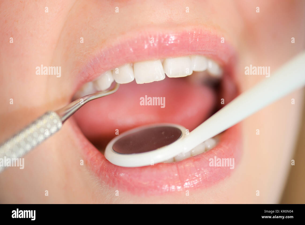 Dentist looking into a woman's mouth Stock Photo