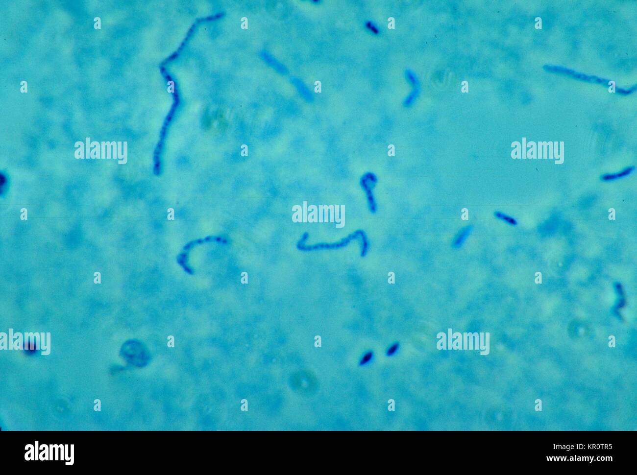 This is a phase-contrast photomicrographic image of Fusobacterium necrophorum, 1965. F. necrophorum is a nonmotile, gram-negative anaerobe that normally inhabitants the pharynx, gastrointestinal tract, and female genital tract. It is one of the major causative agents of Lemierre?s syndrome . Image courtesy CDC/Dr. Lillian V. Holdeman. Stock Photo