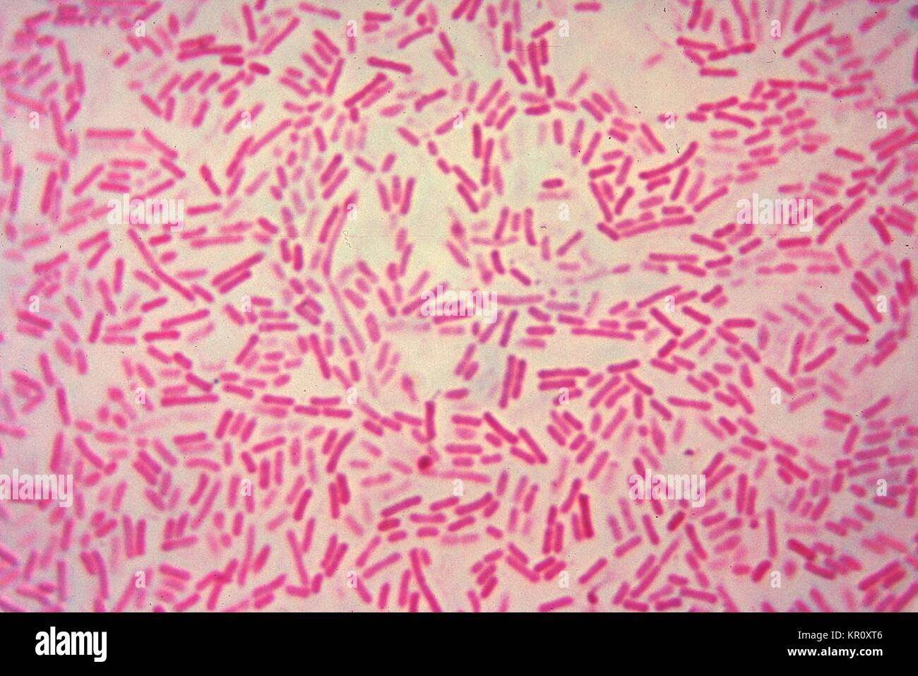 This micrograph depicts Bacteroides hypermegas bacteria cultured in ...