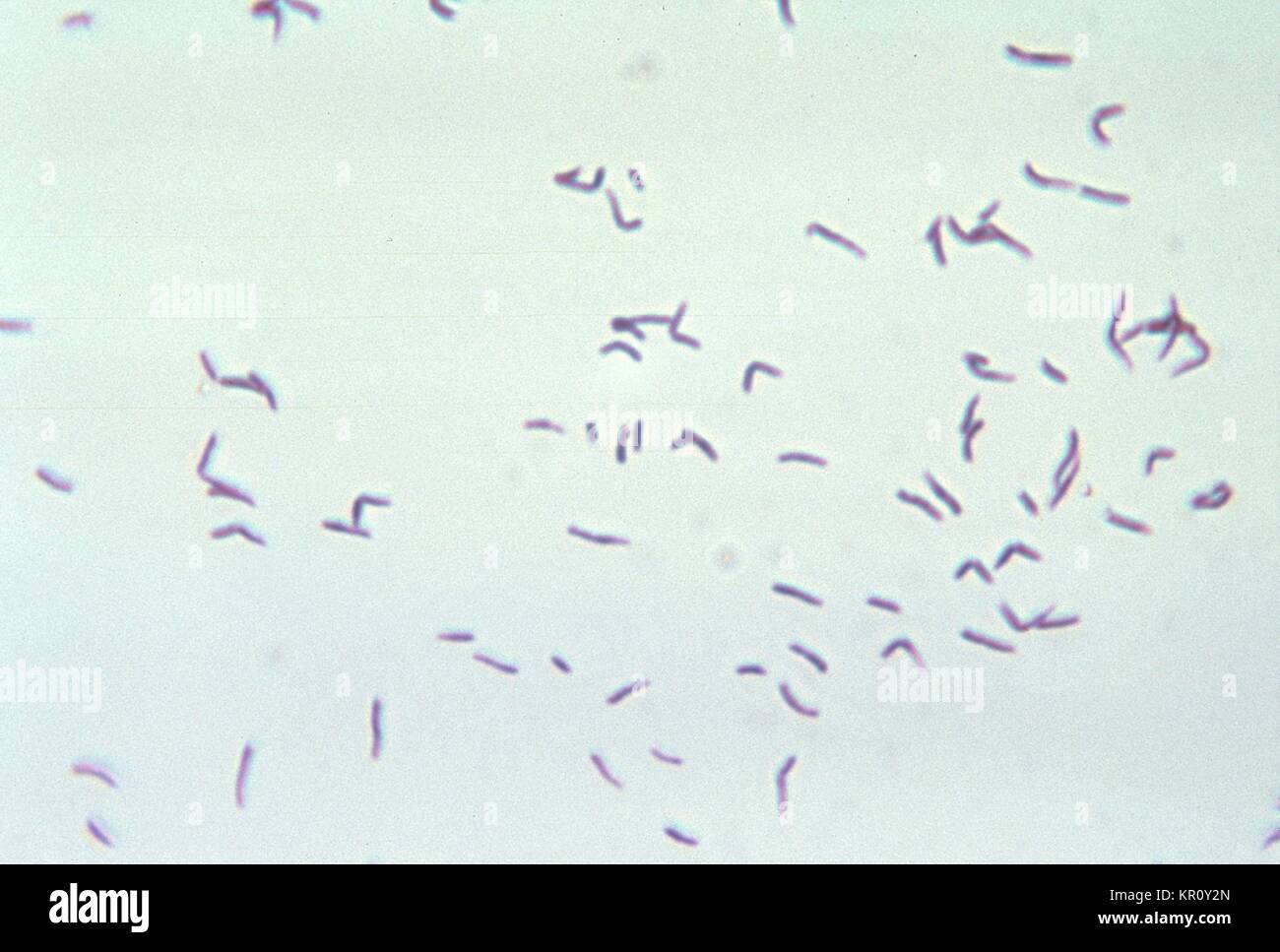 This micrograph depicts the gram-positive bacterium Eubacterium Stock ...