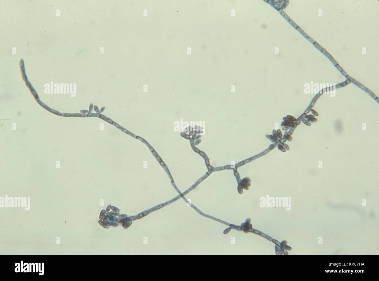 This is a micrograph depicting the fungus Hortaea werneckii, magnified 475X, 1964. Colonies of the species Hortaea werneckii, formerly Cladosporium werneckii, are slow growing, initially mucoid, yeast-like and shiny black. This fungus is a causative agent of tinea nigra in humans. Image courtesy CDC/Dr. Lucille K. Georg. Stock Photo