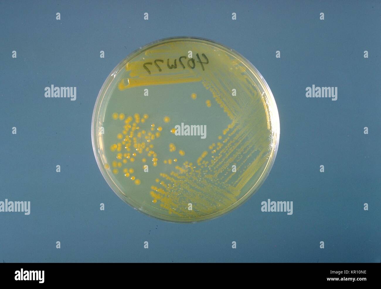This is a trypticase soy agar plate culture of Enterobacter sakazakii after three days of growth at 25{degrees} C. Enterobacter sakazakii, a gram-negative, rod-shaped bacterium, is from the family Enterobacteriaceae, 1978. E. sakazakii is associated with a rare, but often fatal form of neonatal meningitis with a mortality rate of 40 to 80 per cent. Image courtesy CDC/Dr. J. J. farmer. Stock Photo