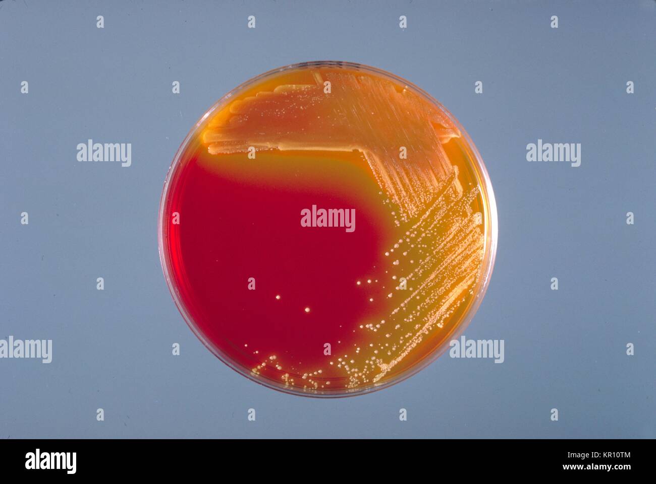 Agar plate inoculated plate hi-res stock photography and images