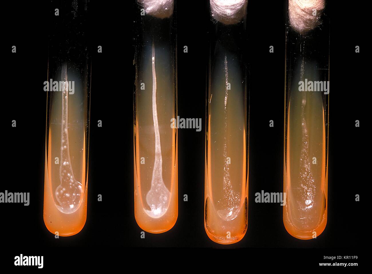 These slant cultures growing Actinomyces viscosus, reveal the oxygen