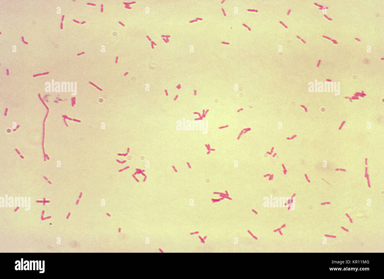 Magnified 1000X, this micrograph depicts Bacteroides fragilis subsp, 1974. fragilis bacteria that had been grown in Schaedler?s broth, and processed using the Gram-stain method. Bacteroides fragilis, a Gram-negative rod, constitutes 1-2% of the normal colonic bacterial microflora in humans. It is associated with extraintestinal infections such as abscesses and soft tissue infections, as well as diarrheal diseases. Image courtesy CDC/Don Stalons. Stock Photo