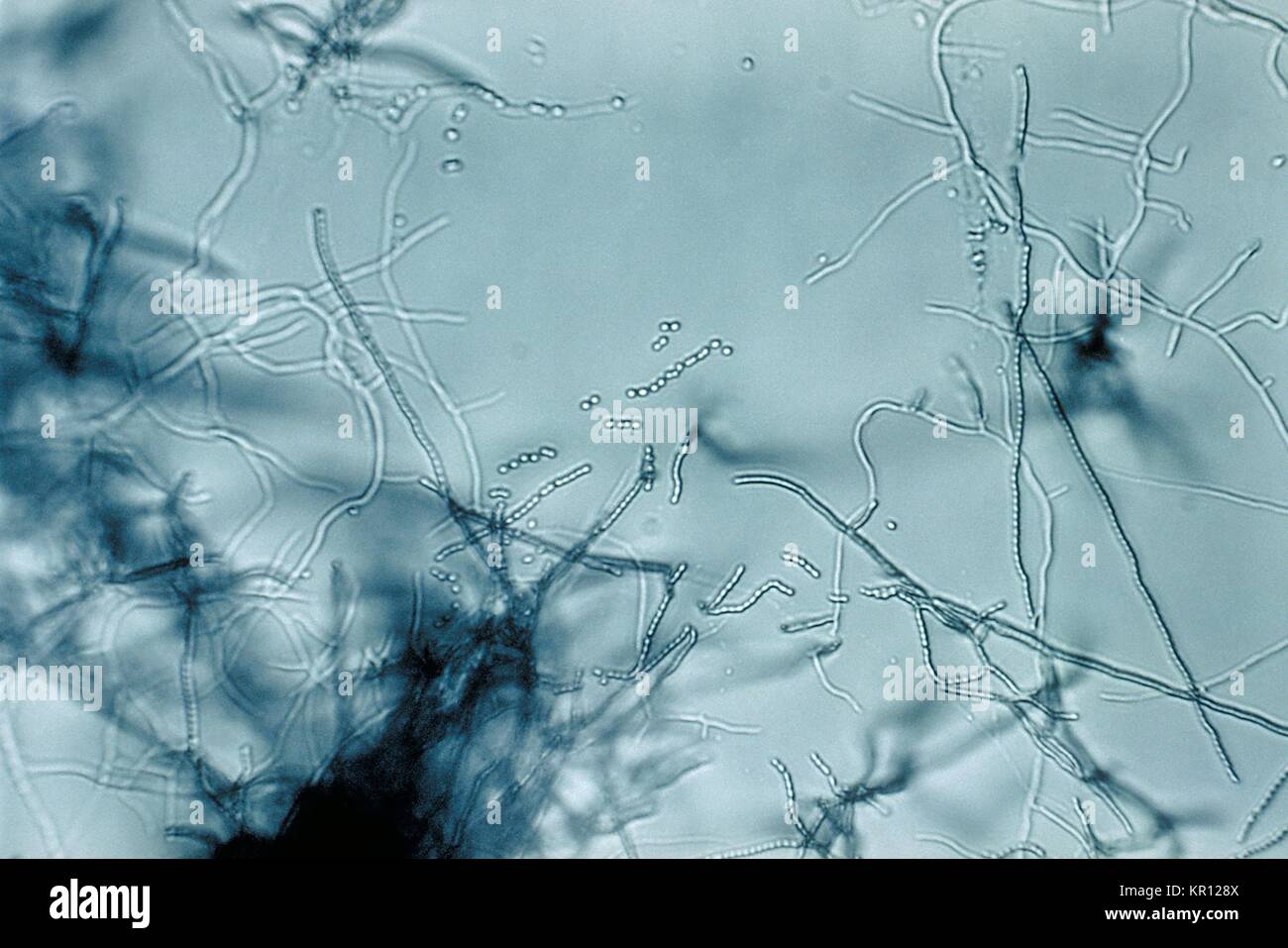 This is a slide culture of a Streptomyces sp, 1972. grown on tap water