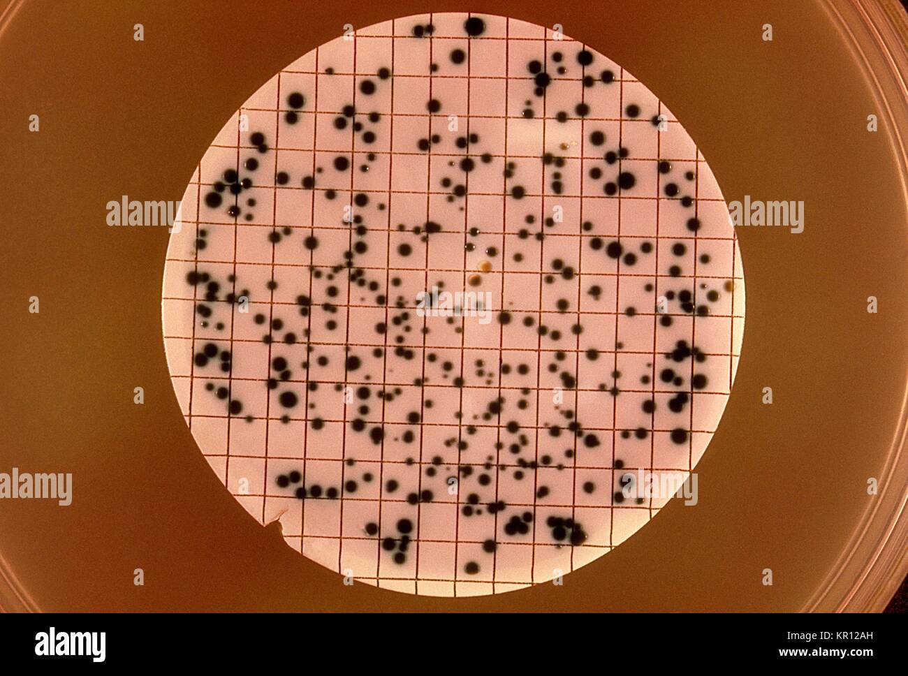 This is a plate culture of Neisseria gonorrhoeae stained with oxidase reagent after 40 hours of incubation, 1972. N. gonorrhoeae, a gram-negative diplococcus, is the causative agent for Gonorrhea. Though these bacteria can infect the genital tract, mouth, and rectum they can become disseminated systemically throughout a person?s bloodstream. Image courtesy CDC. Stock Photo