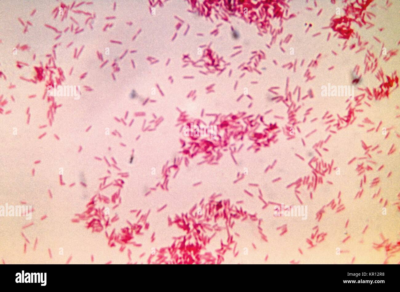 This is a photomicrograph of Fusobacterium russii cultured in a thioglycollate medium for 48 hours, 1972. Like the genus Bacteroides, Fusobacterium are anaerobic, gram-negative bacteria that are normal inhabitors of the intestine. Fusobacterium spp. are associated with pleuropulmonary and oral infections. Image courtesy CDC/Dr. V. R. Dowell, Jr. Stock Photo