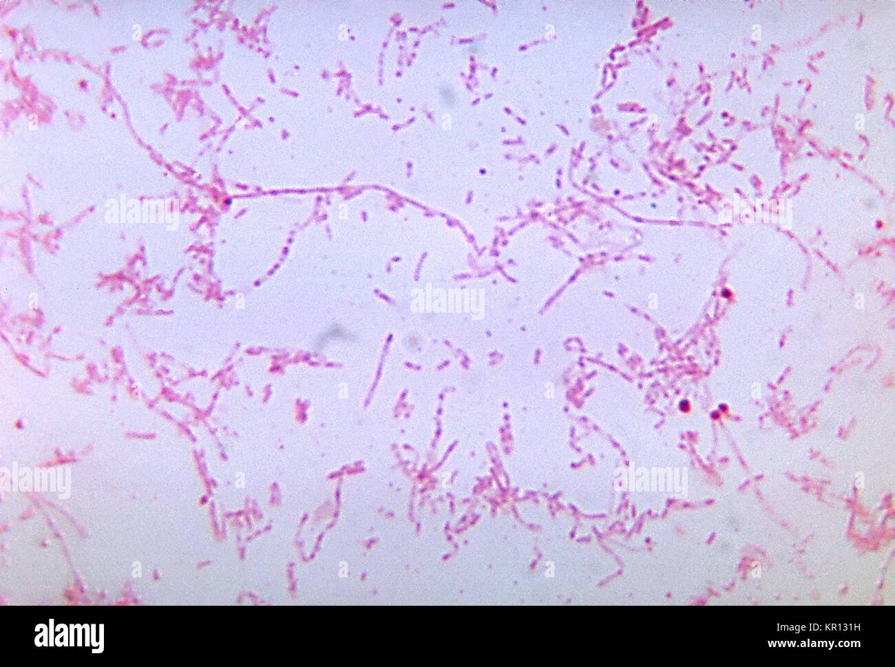 This photomicrograph shows Fusobacterium necrophorum bacteria cultured in a thioglycollate medium for 48 hours, 1972. F. necrophorum is a nonmotile, gram-negative anaerobe that normally inhabitants the pharynx, gastrointestinal tract, and female genital tract. It is one of the major causative agents of Lemierre?s syndrome . Image courtesy CDC/Dr. V. R. Dowell, Jr. Stock Photo