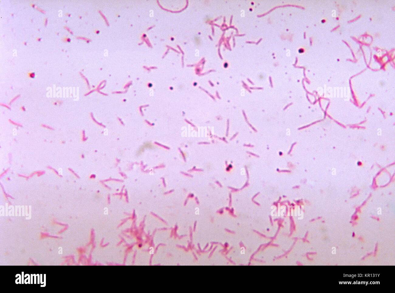 Fusiform Bacteria