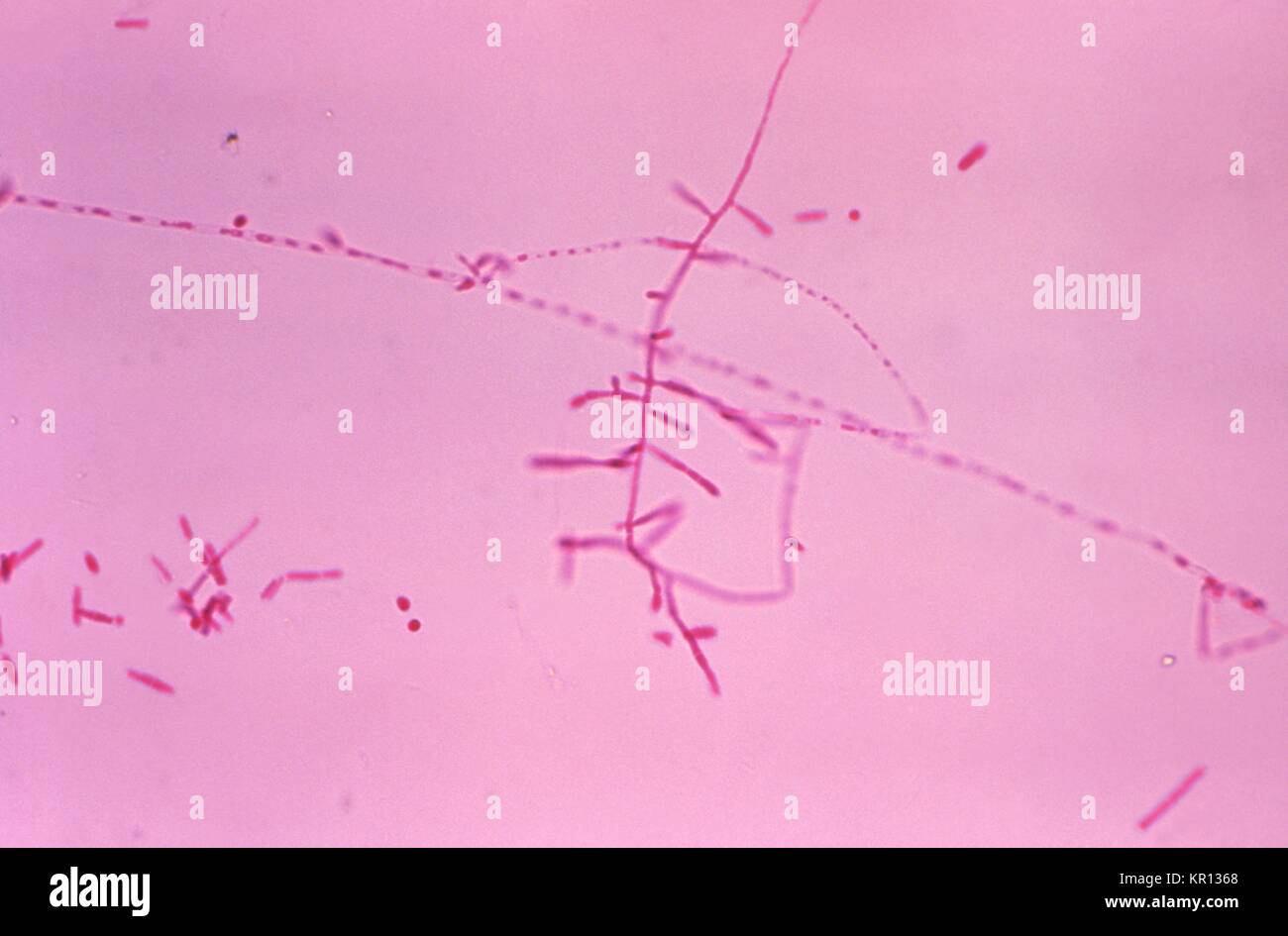 This is a photomicrograph of Trichophyton mariatii during a hair perforation test, 1979. Members of the genus Trichophyton inhabits the soil, humans or animals and is one of the leading causes of hair, skin and nail infections, i.e. dermatophytosis, in humans. Image courtesy CDC/Dr. Arvind A. Padhye. Stock Photo