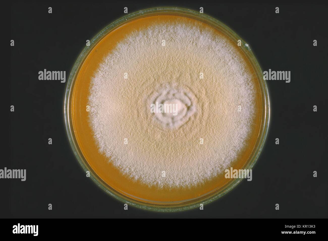 This is a top view of a plate culture containing the fungus Trichophyton mentagrophytes, 1964. From the front, the color is white to bright yellowish-beige or red-violet. The genus Trichophyton inhabits the soil, humans or animals, and is one of the leading causes of hair, skin and nail infections, i.e. dermatophytosis, in humans. Image courtesy CDC. Stock Photo