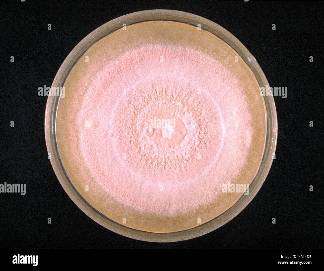 This photograph depicts Sabouraud?s dextrose agar plate of the fungi Microsporum vanbreuseghemi, 1961. M. vanbreuseghemi colonies grow rapidly, and mature in a week. The front color is cream-yellow, pink or tan with a lemon-yellow, or yellow to orange diffusible pigment observed from the reverse. Image courtesy CDC/Dr. Georg. Stock Photo